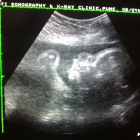 My Sonography Pics