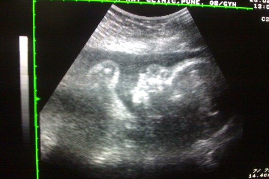 My Sonography Pics